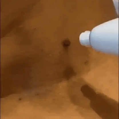 Skin Tag Remover Kit