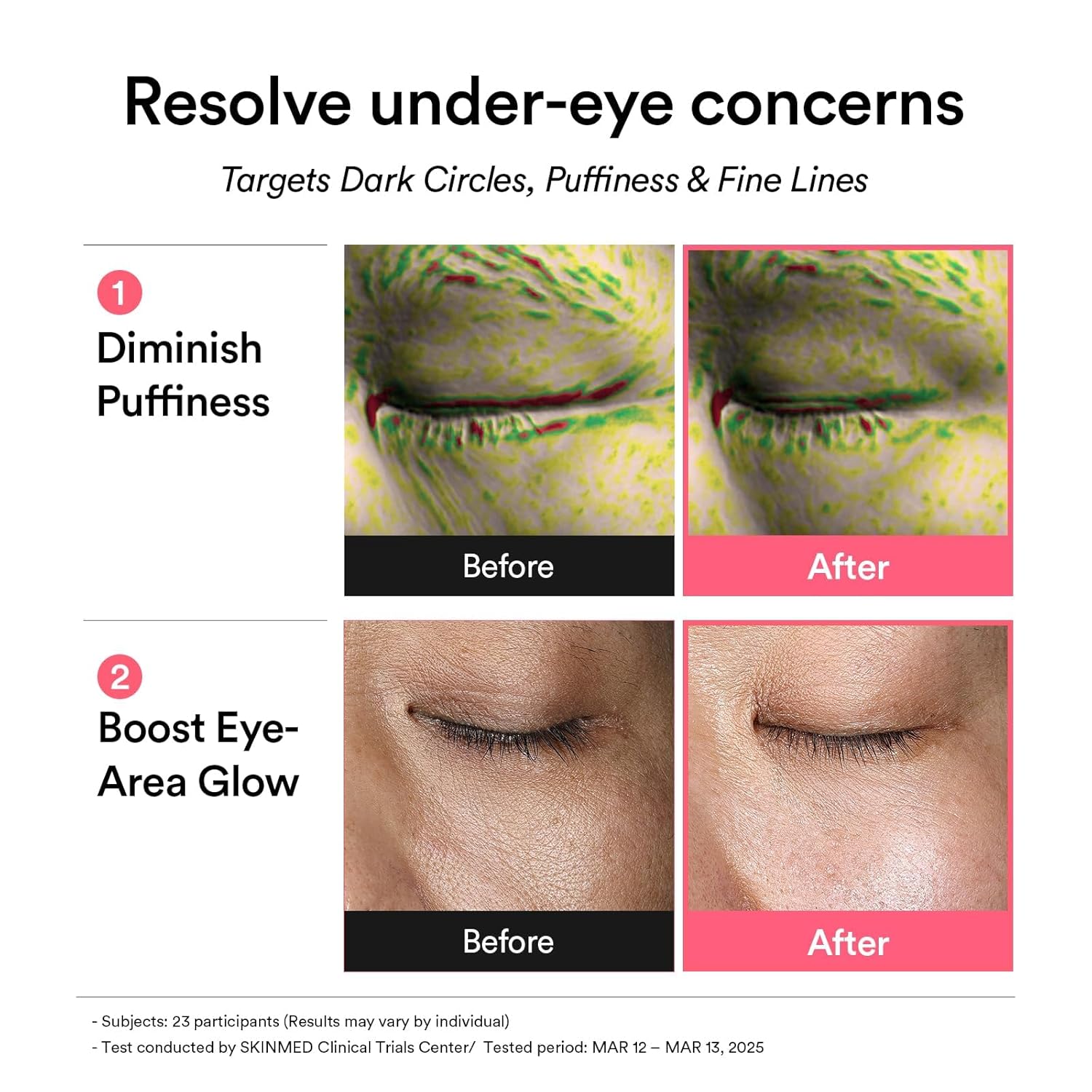 Puffiness & Dark Circle Remover Eye Patches