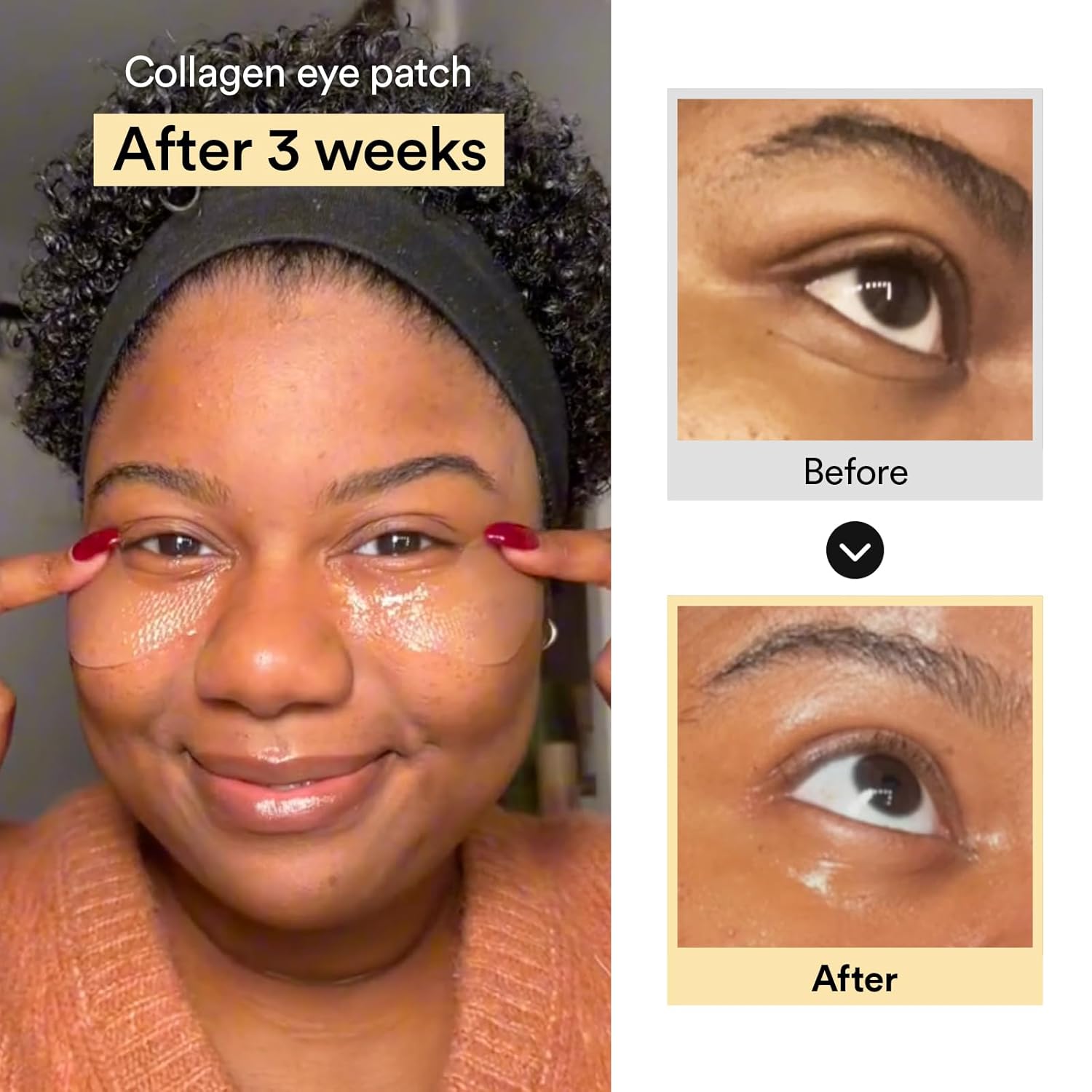 Puffiness & Dark Circle Remover Eye Patches