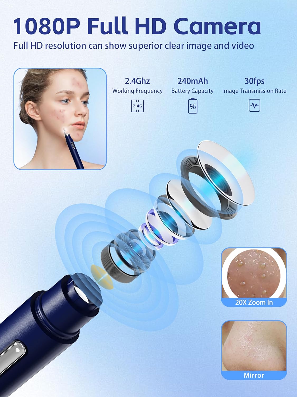 Blackhead Remover